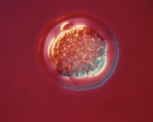embroy Sixteen (16) cell stage mouse embryo 3 days post conception,160x magnification. Original public domain image from Flickr